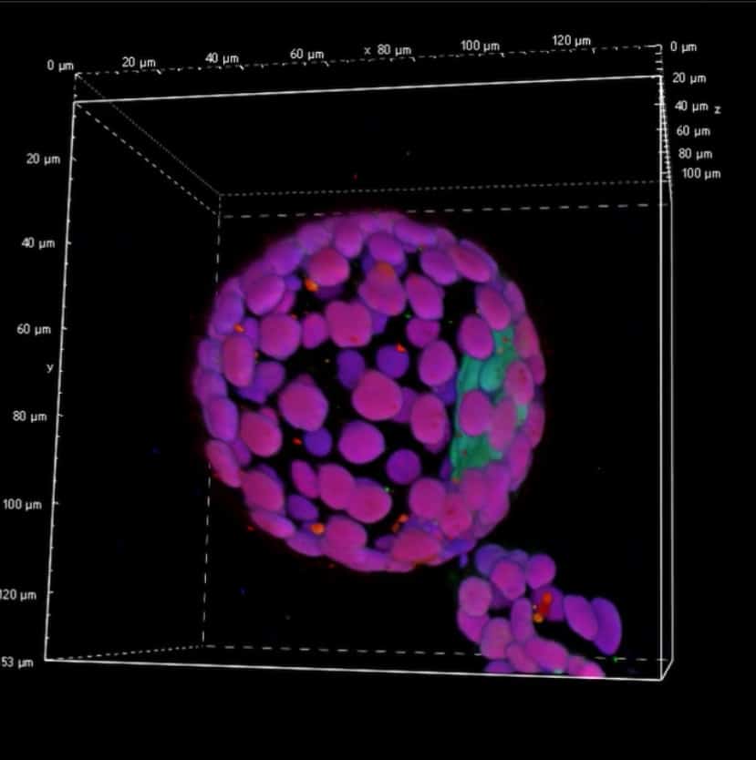 Hatching Mouse Blastocyts stained for GATA4