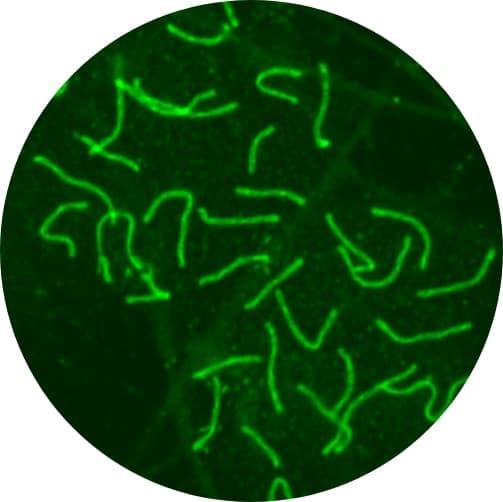 Blurry image Confocal