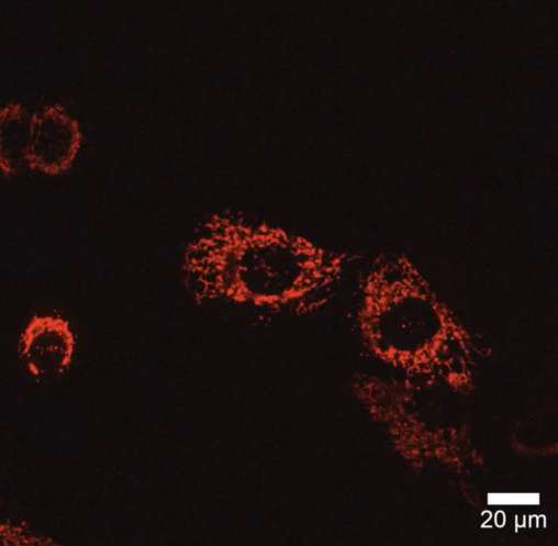 Higher sensitivity and less phototoxicity RCM1