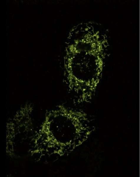 Perks of Re scan confocal