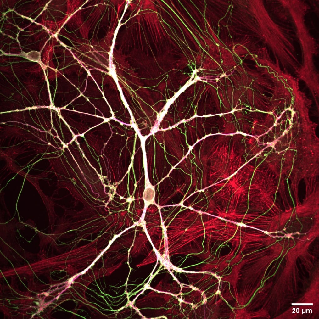 RCM2 Neurons 40x