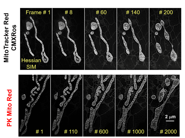 PK mito red imagining