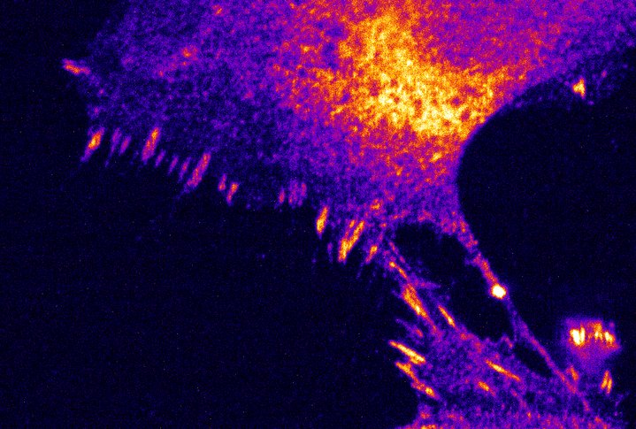 Fluorescence microscopy Nobel Prize