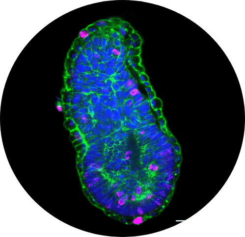 video embeded overlay