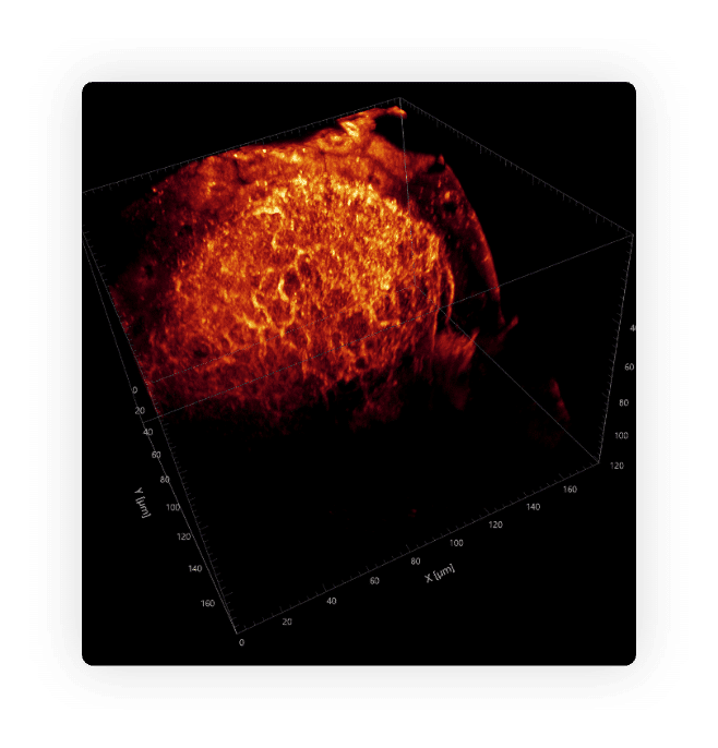 Deep in super resolution